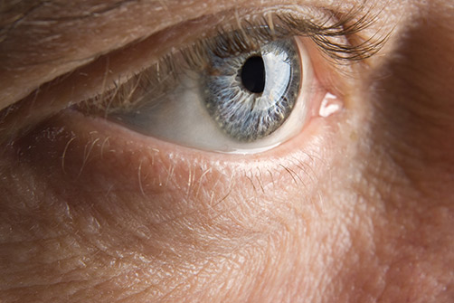 Multifocal Intraocular Lens